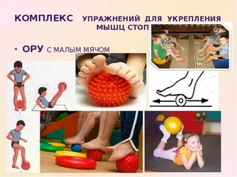 Плоскостопие  КОРРЕКЦИЯ