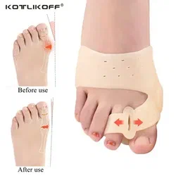 Плоскостопие  КОРРЕКЦИЯ